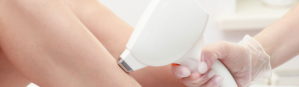 Epilation définitive au laser